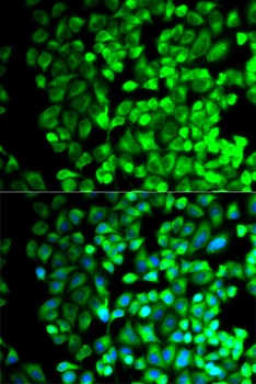 TBXAS1 Antibody