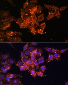 TGM1 Antibody