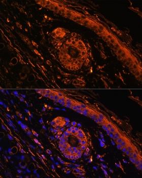 TGM1 Antibody