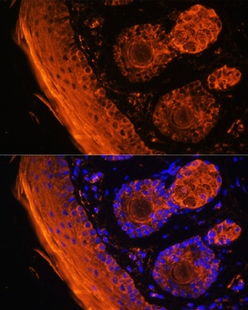 TGM1 Antibody