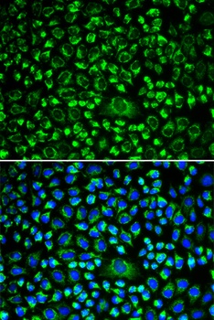 TAPBP Antibody