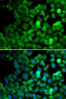 SARS Antibody