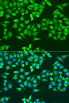 RRM1 Antibody