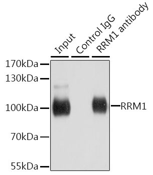 RRM1 Antibody