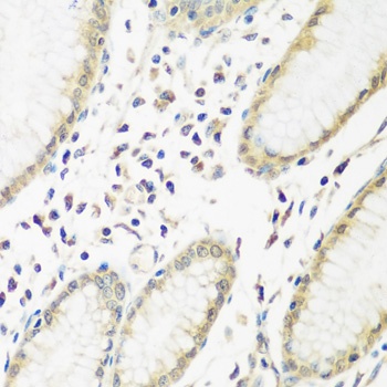 PYCR1 Antibody