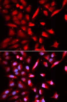 PSMC3 Antibody