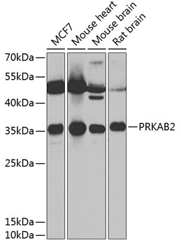 PRKAB2 Antibody