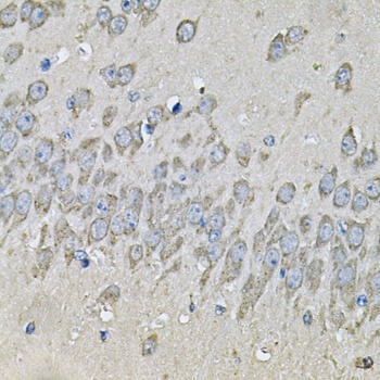 PRKAB2 Antibody