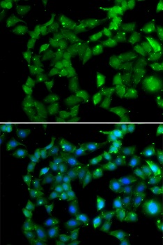 PRKAB2 Antibody