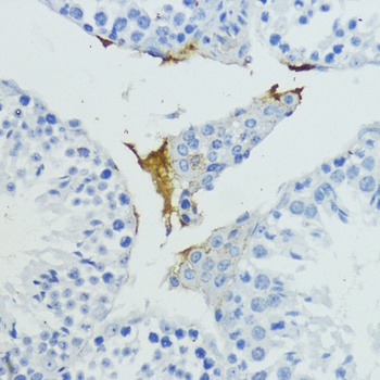 KLKB1 Antibody