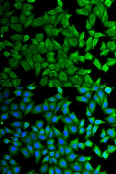 KLKB1 Antibody