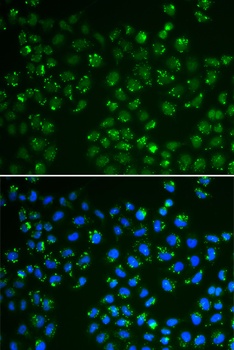 GPX4 Antibody