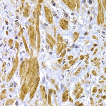 DSP Antibody