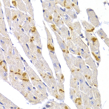 DSP Antibody