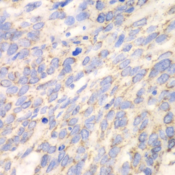 DLD Antibody