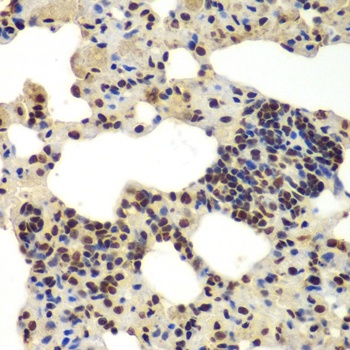 DDX5 Antibody