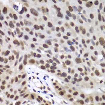 DDX5 Antibody