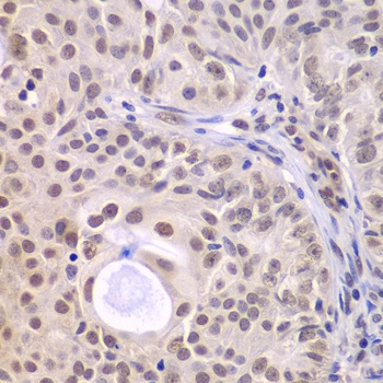 DDX5 Antibody