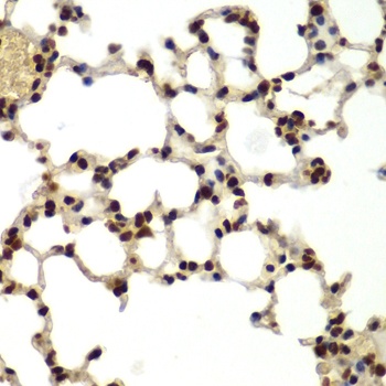 DDX5 Antibody