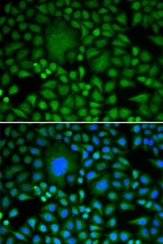 DDX5 Antibody