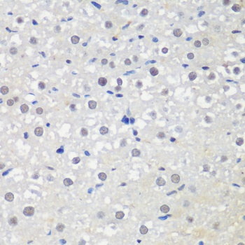 CTCF Antibody