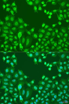 CTCF Antibody