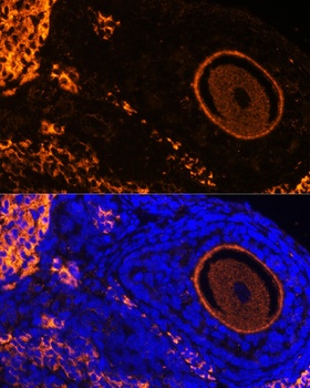 CTCF Antibody