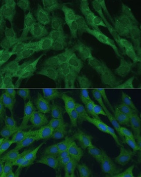 IDH1 Antibody