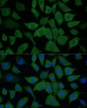 IDH1 Antibody