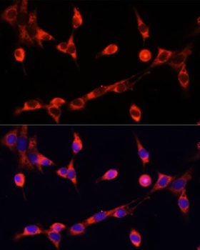 CHAT Antibody