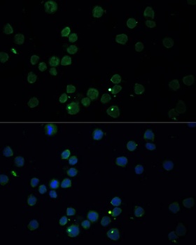 CHAT Antibody