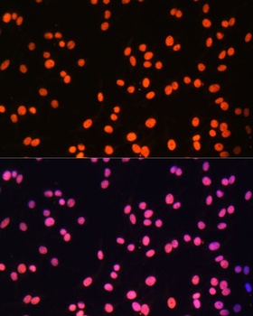ZNF581 Antibody