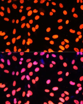 ZNF581 Antibody