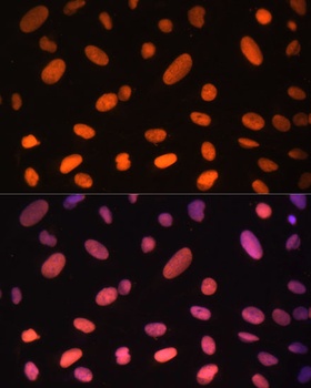 ZNF581 Antibody