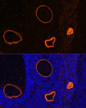 ZP3 Antibody