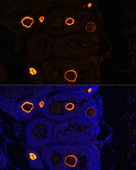 ZP3 Antibody