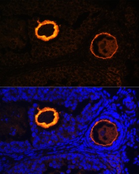 ZP3 Antibody