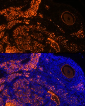 ZP3 Antibody