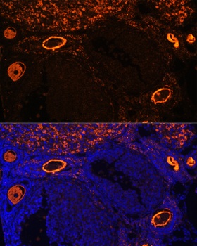 ZP3 Antibody