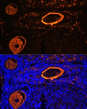 ZP3 Antibody