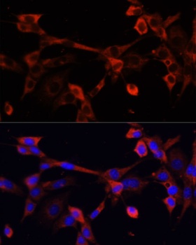 DNASE1L1 Antibody