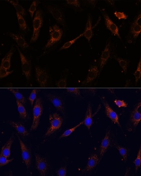 VPS25 Antibody