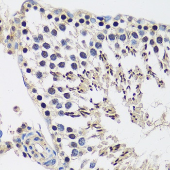 CASC5 Antibody