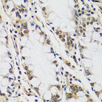 CASC5 Antibody