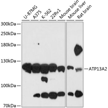 ATP13A2 Antibody