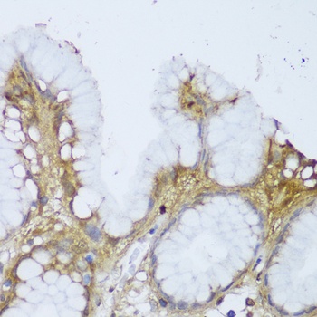 GCN1L1 Antibody