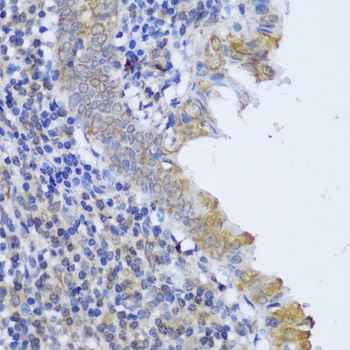 GCN1L1 Antibody