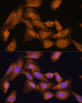 RPL27 Antibody