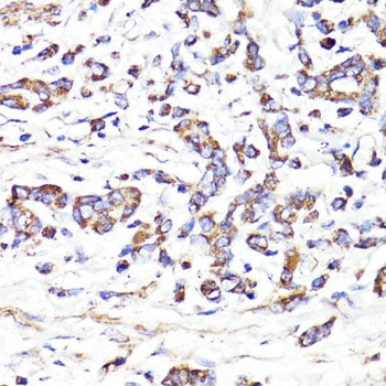 IGF2R Antibody