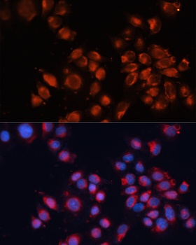 IGF2R Antibody